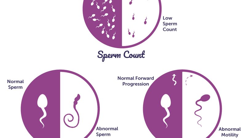 Diagram of key factors of sperm health created by the expert Andrology team at Semovo